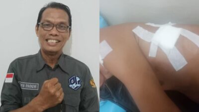 DPD Pro Jurnalismedia Siber Meminta Polrestabes Palembang Turun Tangan Tangkap Pelaku Penusukan